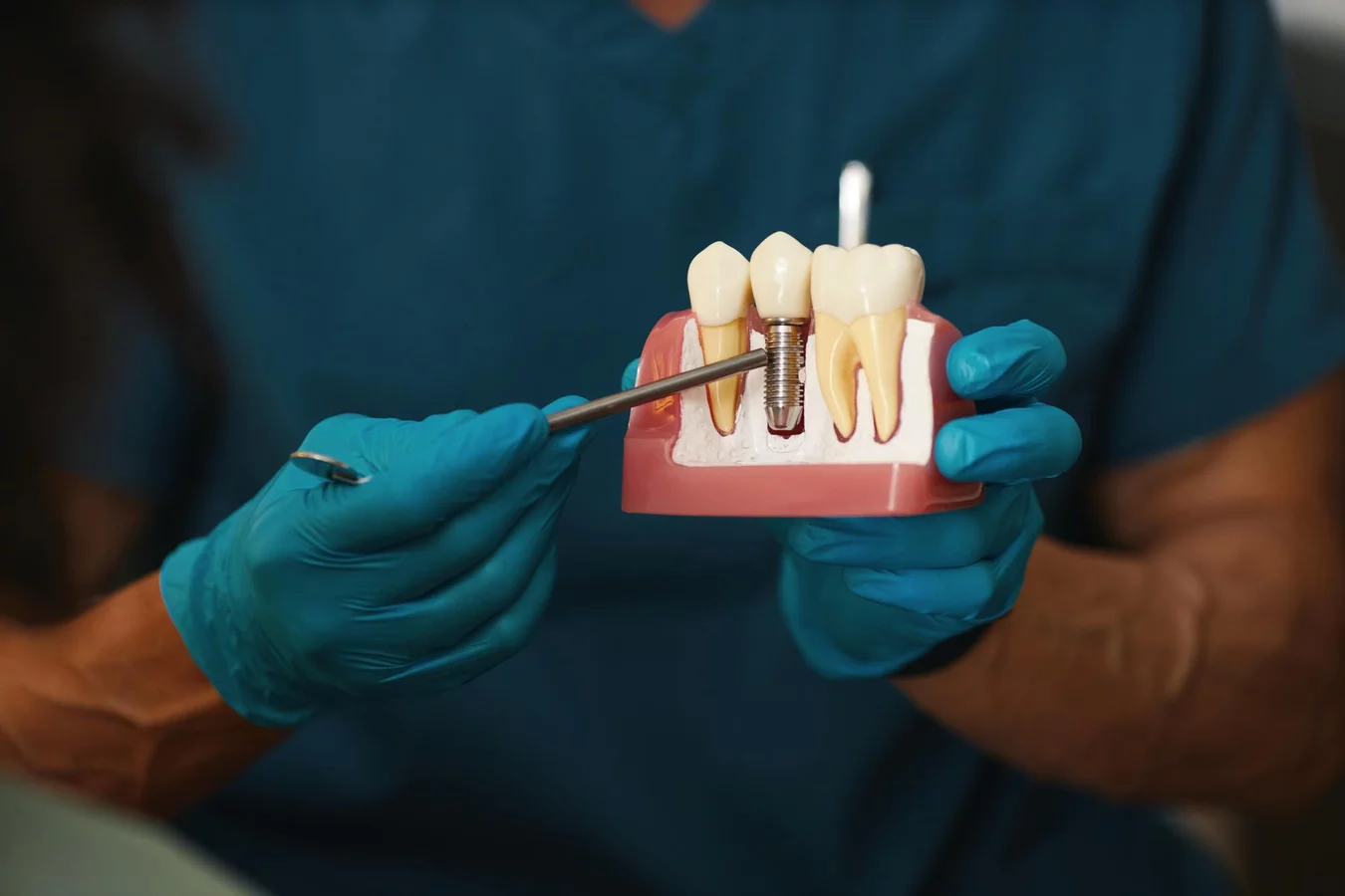 Etap 2: Przygotowanie do zabiegu implantacji